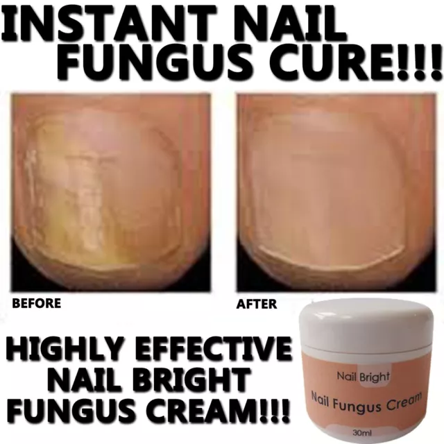 Nail Bright Nail Fungus Cream Lotion Grow Long Nails Strong 100% Natural