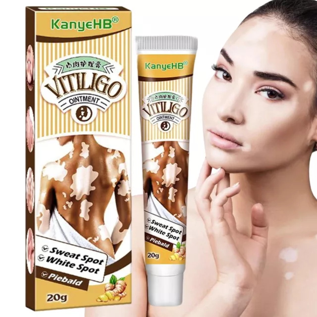 20g Vitiligo Leukoplakia Treatment Ointment White Spot Patches Repair Cream