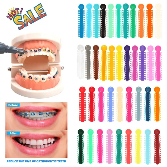 1040 piezas Las ligaduras de ortodoncia dental atan bandas de goma elásticas QK