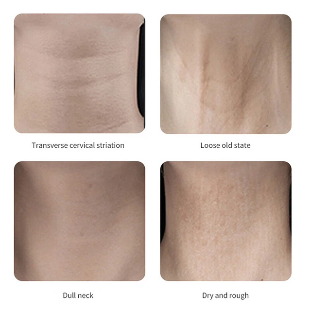 Toppe antirughe istantanee viso collo lifting occhi viso nastro lifting