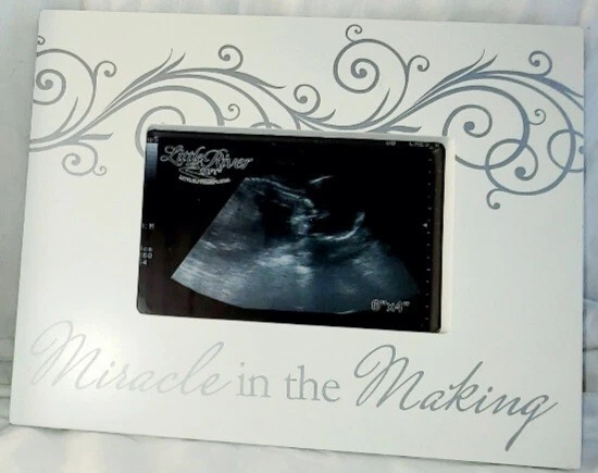 "Miracle In The Making" Personalized Sonogram Photo Frame ~