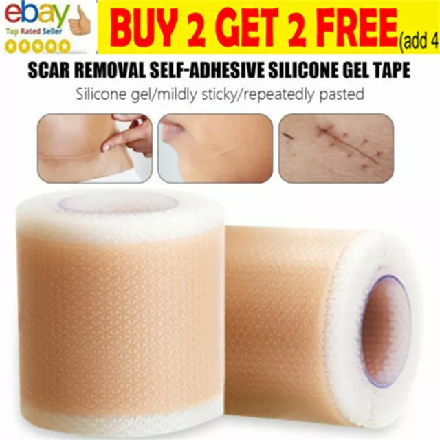 Efficient Beauty Scar Removal Silicone Gel Self Adhesive Silicone Gel Tape PatDH