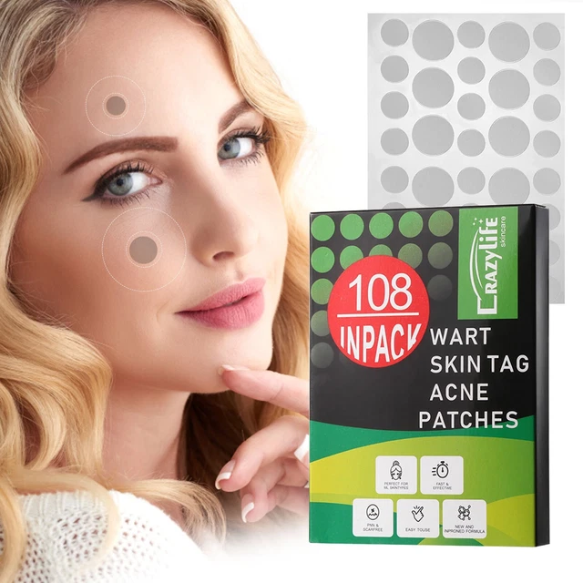 Pegatinas para eliminar el acné con parche de granos máscara facial tratamiento del acné invisible
