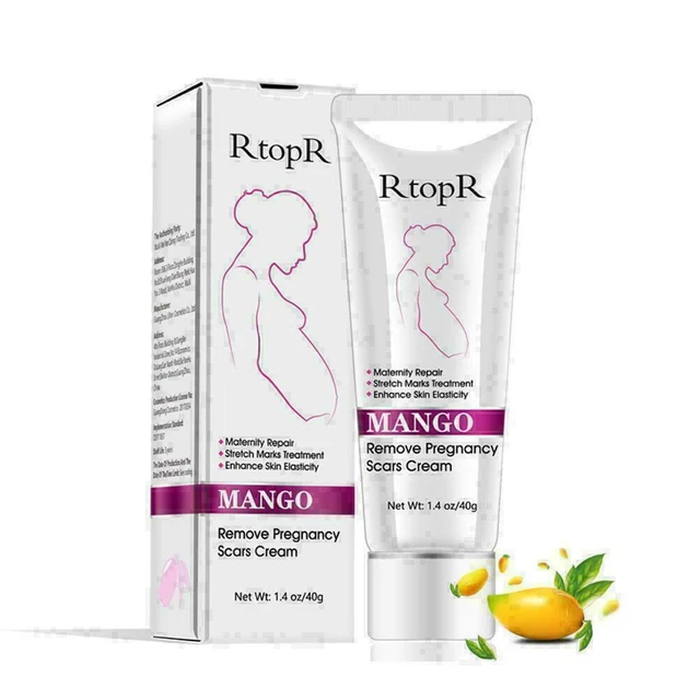 40 Ml Rtopr -Mango Entfernen Sie Schwangerschaftsnarben Creme Creme Ho B9S7 F8P5