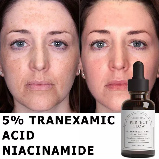 Tranexamic Acid Hydrating Serum 30ml Plump and Smooth Skin for All Skin Types