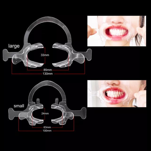 Dental Orthodontic C Type Transparent Intraoral Lip Cheek Retractor Mouth Opener