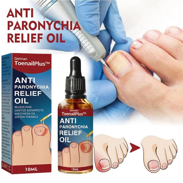 1* Toenailplus NailProp Anti Paronychia Relief Oil 2023 BEST