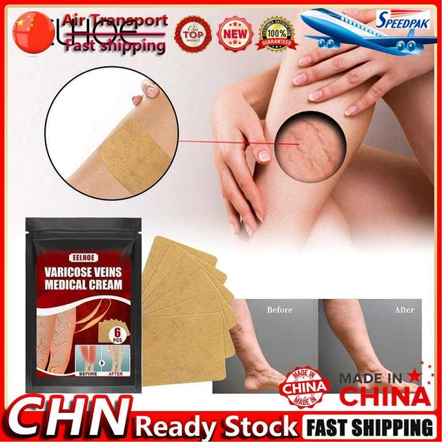 Varicose Vein Relief Patch Relieve Lower Extremity Pain Fatigue for Body Health