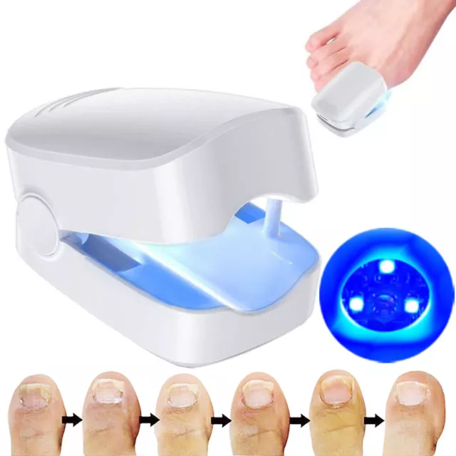 Nail Fungus Laser Device Light Therapy Onychomycosis Toes Treatment for Home