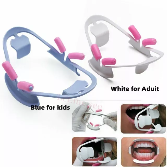 Dental Orthodontic Kids 3D Oral Mouth Opener Intraoral Cheek Lip Retractor Prop