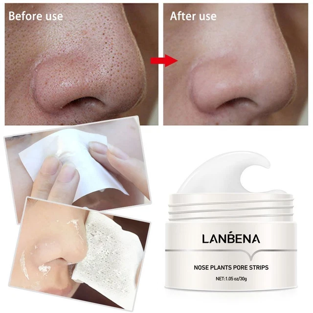 streifen Poren band Maske Nase Gesichts maske Mitesser entferner Akne-Peeling