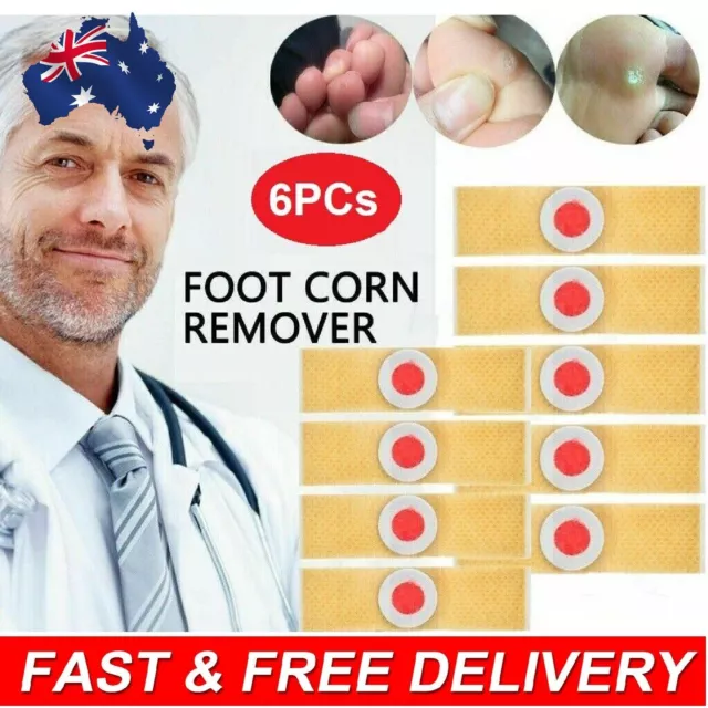 Foot Corn Remover Pads Plantar Wart Thorn Plaster Patch Callus Removal Effective