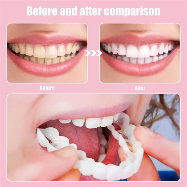 Snap On Pair Upper and Lower Smile Cosmetic Dental White Teeth Denture Veneers