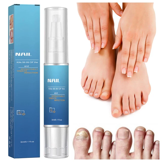 ANTI FUNGAL NAIL Treatment Finger Toe Care Fungus Liquid Repair Pen