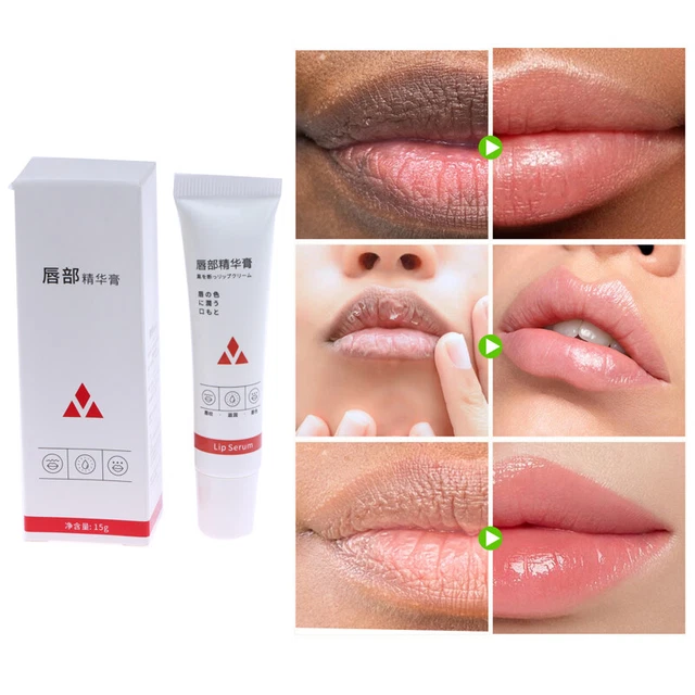 Lips Pink Fresh Fast Lightening Bleaching Cream Balm Treatment Removes Dark  LEI
