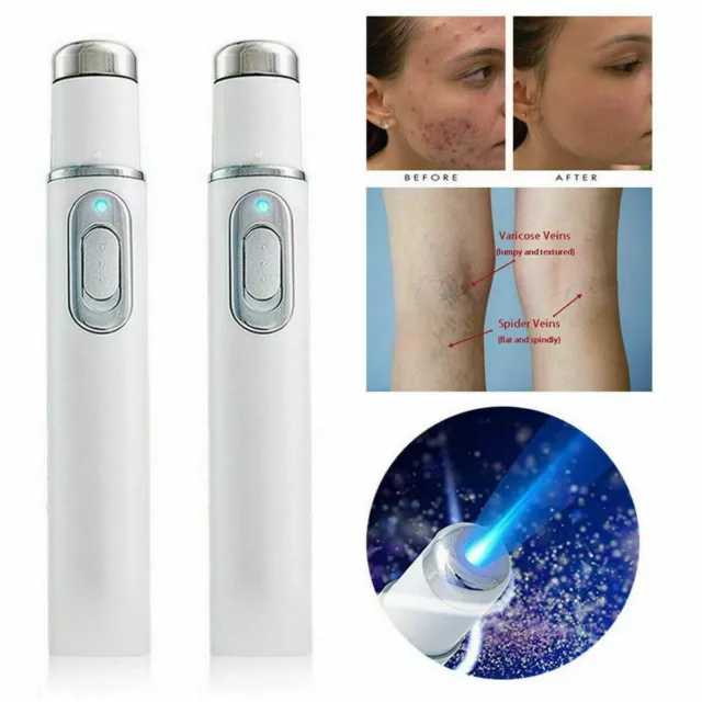 NEU LCD Laser Plasma Pen Mole Dark Spot Skin Wart Tag Tattoo Removal Beauty Care