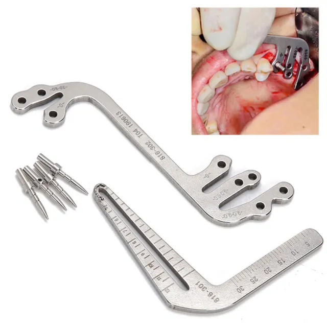 Chirurgie D'implant Dentaire Instrument De Plantation Orale Guide De Positionnem