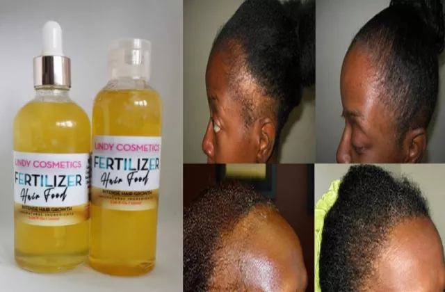 Hair Growth FERTILIZER Oil + Butter *100% NATURAL Hair Food*