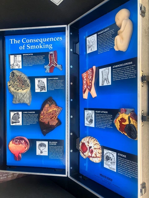 Two Health Edco 3D Training Medical Office Displays "Smoking""Secondary Smoking"