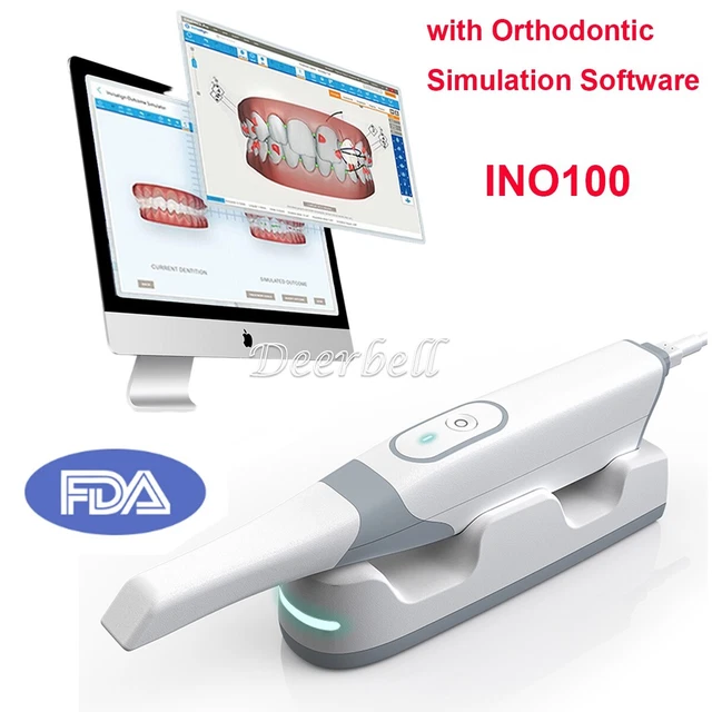 DENTAL INTRAORAL 3D Scanner CAD/CAM Chair Side System/Ortho Simulation ...