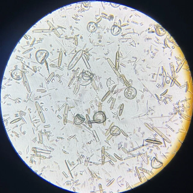 J.D. Moller Microscope Slide Diatom Brohl Thal Earth Germany Gold Medal 1869