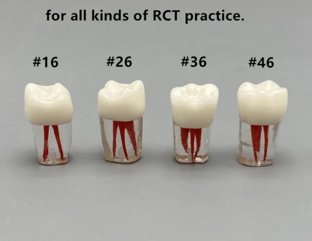 5pcs Dental Root Canal Teeth Study Practice Model Endodontic RCT Endo Pulp File