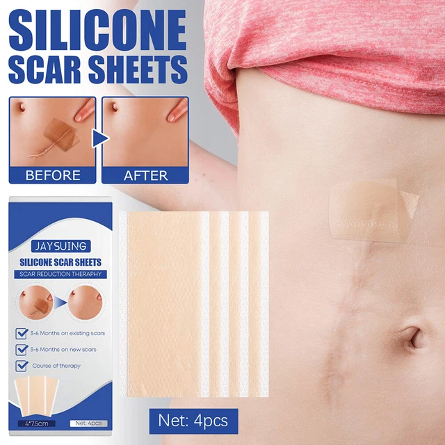 4 pz patch gel di silicone leggero portatile per strumenti di riparazione pelle -