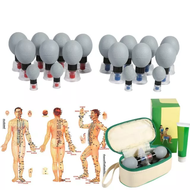 Set coppetta per digitopressione digitopressione terapia sottovuoto Haci TCM moxibustione