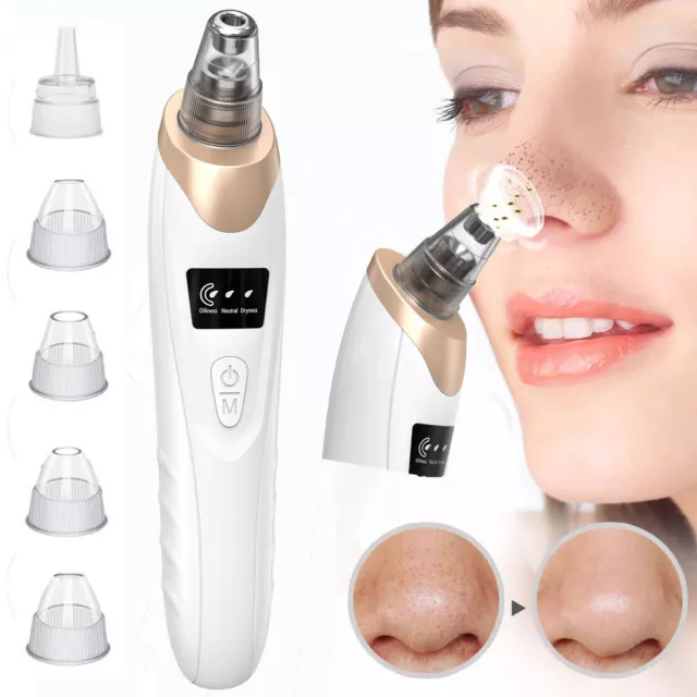 Electric Blackhead Facial Remover Vacuum Pore Cleaner Skin Face Machine Acne Dot
