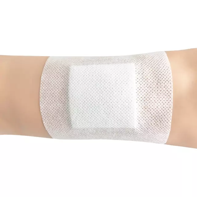 Softpore Adhesive Dressing 10 x 15cm - Pack of 50