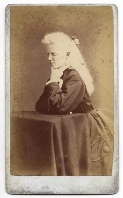 Antique ALBINO WOMAN Victorian CIRCUS SIDESHOW Freak Show ORIGINAL CDV PHOTO