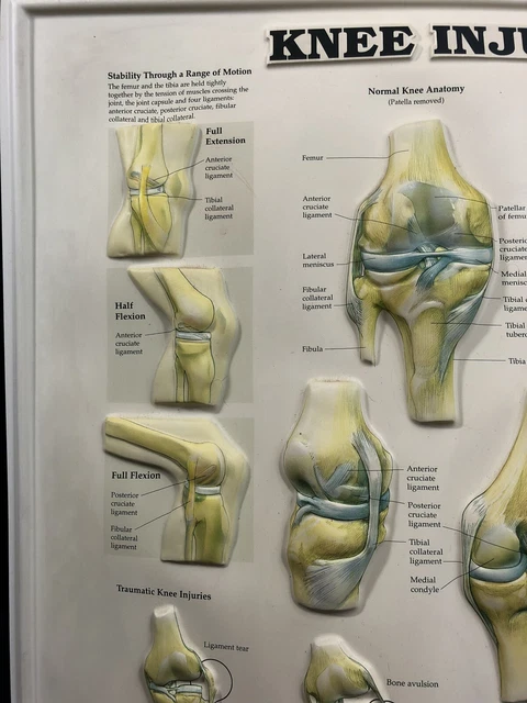 VINTAGE ANATOMICAL “KNEE Injuries” Medical Chart 3D Poster Rare £29.99 ...