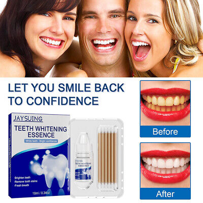 Blanqueamiento dental Essences extra fuerte blanco higiene dental blanqueador noble ampliación ☀