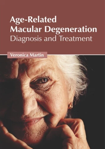 AGE-RELATED MACULAR DEGENERATION: Diagnosis and Treatment by Veronica ...