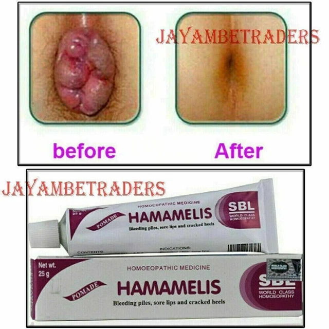 Antibakterielle pflanzliche Hämorrhoiden Creme innere Stapel anal Juckreiz Behandlung 25g