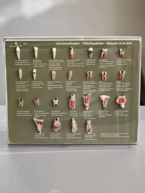 Schaukasten "Zahnkrankheiten" ES 7 SOMSO-Plast®Zähne- natürlicher Größe Zahnarzt