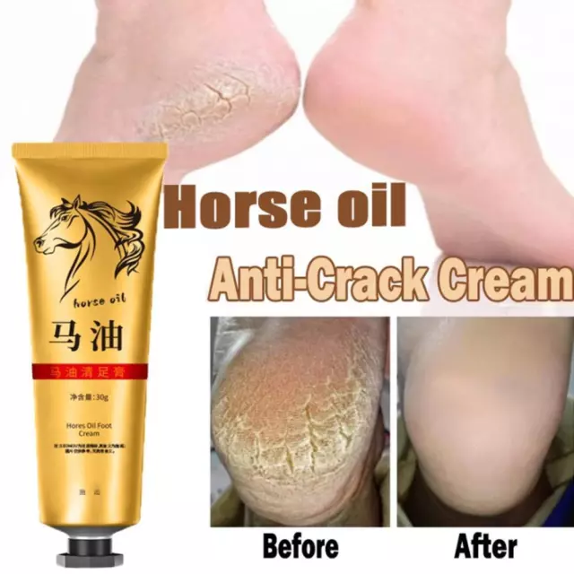 Huile Cheval Crème Pieds Mains Anti-Âge Peau Sèche Peeling Réparatrice Hydrata `