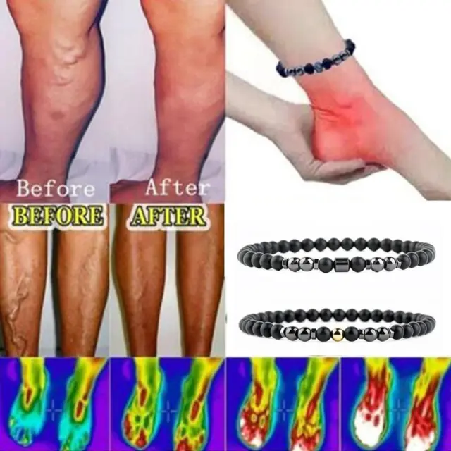 1PCS Anti Varicose And Swelling Magnetotherapy Anklet Y2M0