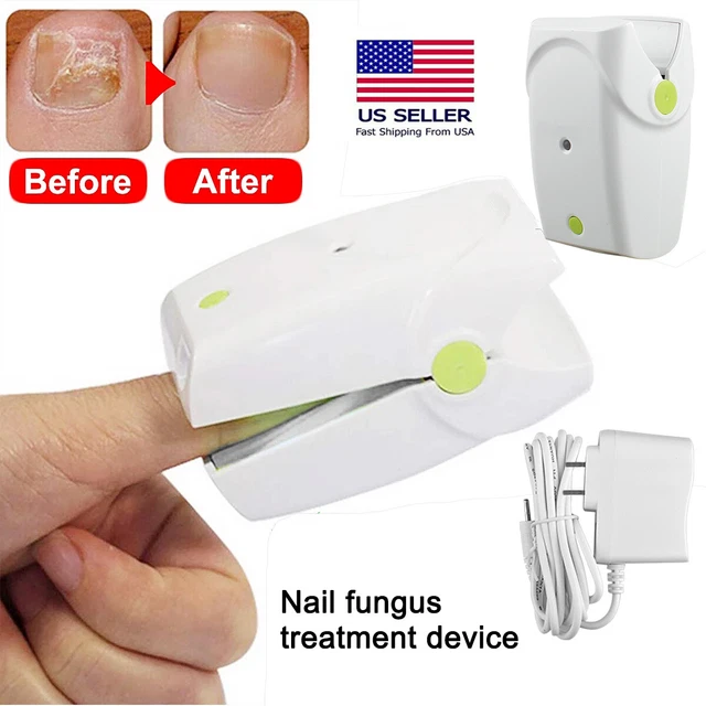 NAIL FUNGUS LASER Device Light Therapy Antifungal Onychomycosis Toes
