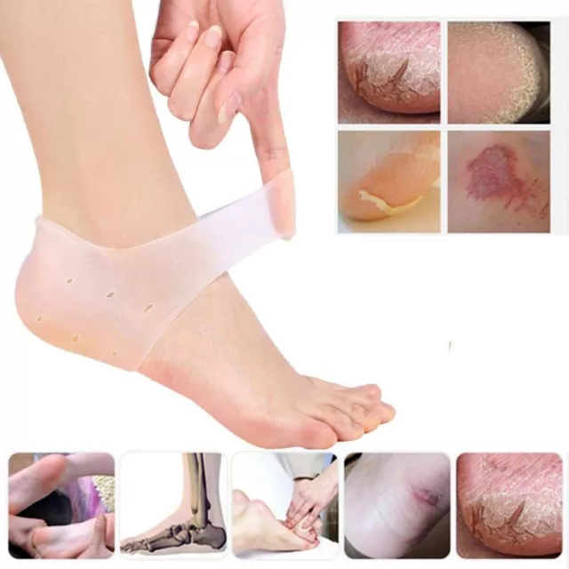2x SILICONE GEL HEEL SLEEVES Cracked Foot Skin Care Protector Socks UK