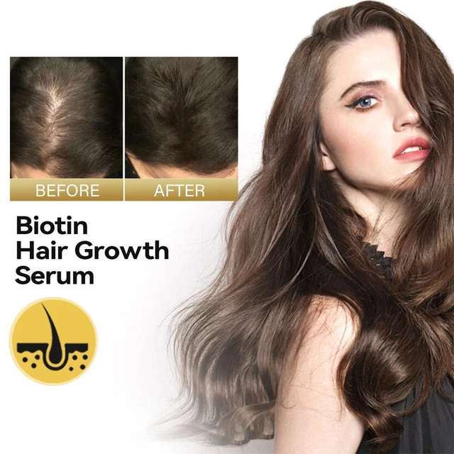 Suero de raíz de crecimiento del cabello biotina nutritivo cabello denso anti pérdida de cabello;