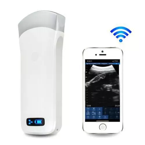 Portable MINI WIFI Wireless Ultrasound Scanner Convex Array Probe 3.5Mhz USB A+