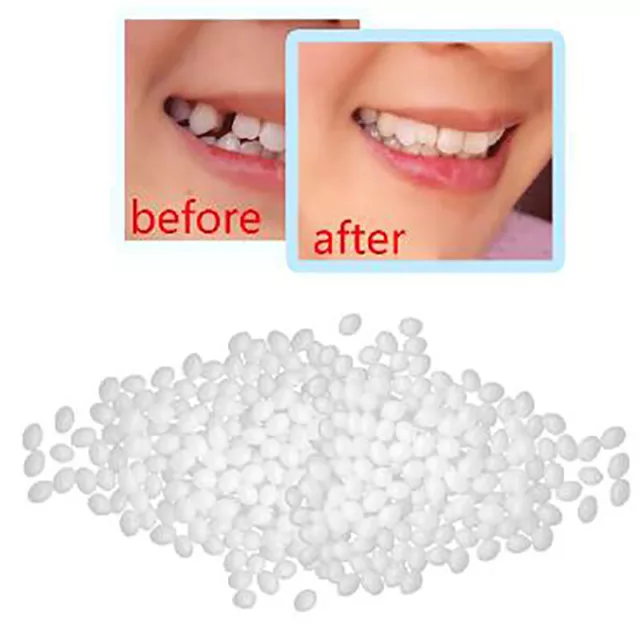 1Denture Solid Glue Dental Restoration Temporary Tooth Repair Kit Teeth#7H