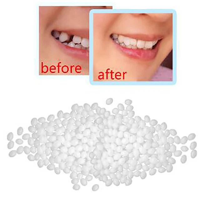 1Denture Solid Glue Dental Restoration Temporary Tooth Repair Kit Teeth AnX^ob