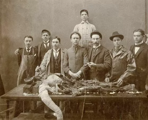 Antique Medical Autopsy Photo 571b Oddleys Strange & Bizarre