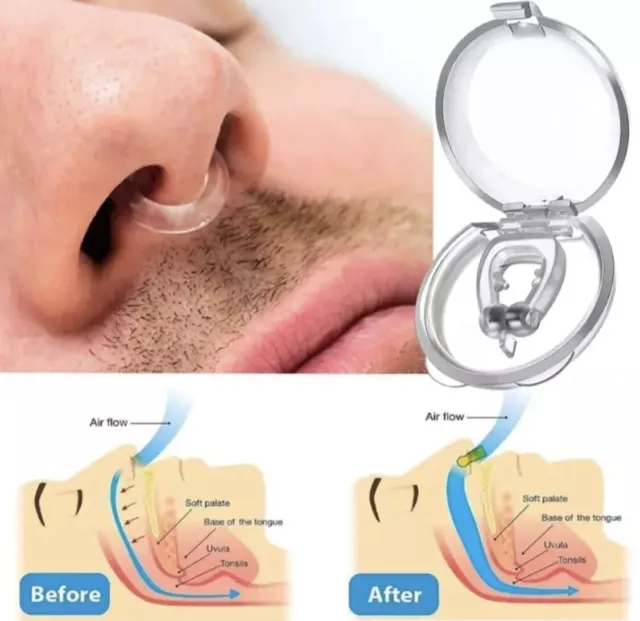 New Anti Snoring Magnetic Nasal Dilator Stop Snore nose clip with Hygiene Uk