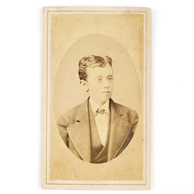 New York Boy CDV Photo c1865 Otto Wagner Masked Young Man Photo Portrait A3261