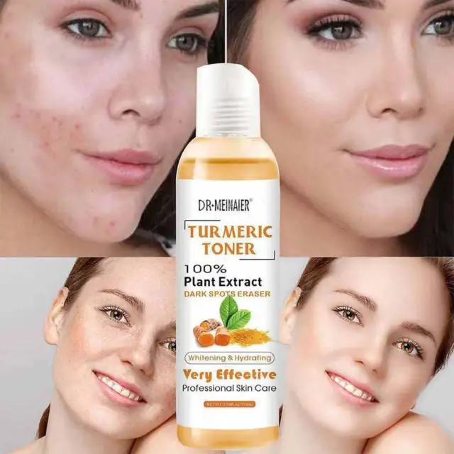 Turmeric Toner Dark Spots Facial Toner Spots Eraser Skin Skin Care 118ml UK