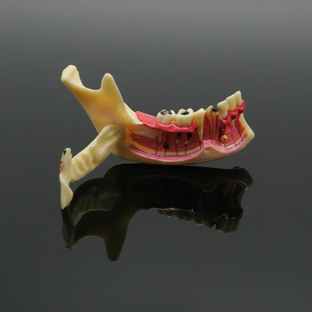 DENTAL DEMONSTRATION EDUCATION Mandibular Tissue Anatomical Model ...