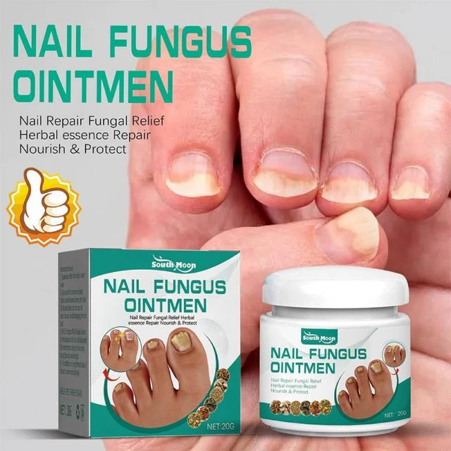 NAIL FUNGUS FUNGAL Removal Cream Treatment CareOnychomycosisInfectionToenail EUR 3,35